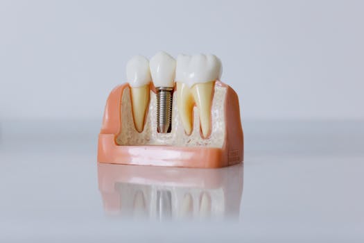 Dental Implants In Shree Datta Multi Specialty Dental & Implants Center